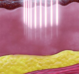 Divine_Pro_D_good_3_260x246