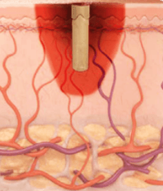 Continuous Wave pulse profile illustration