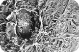 ALT_50Mm-B_W Electron microscopy of TM after ALT