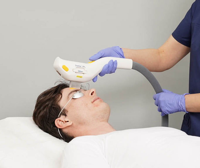 A patient receiving IPL technology for dry eyes treatment