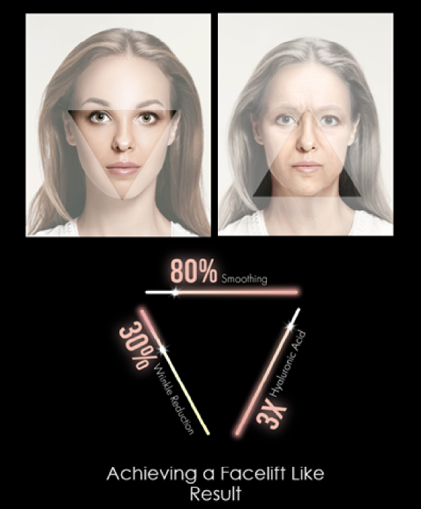 triLift results before and after