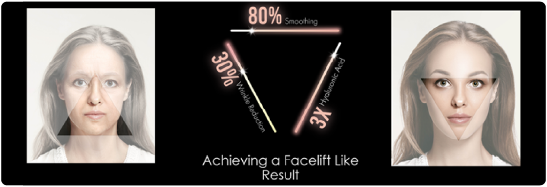 triLift results before and after