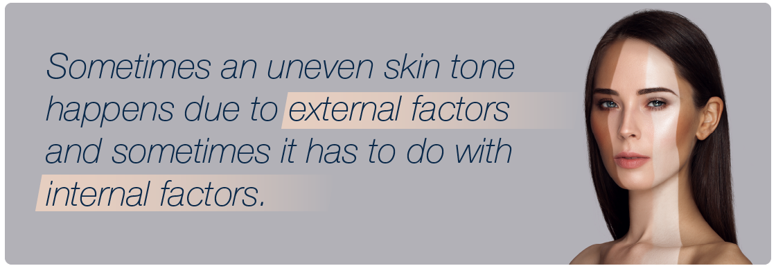 Sometimes an uneven skin tone happens due to external factors and sometimes it has to do with internal factors