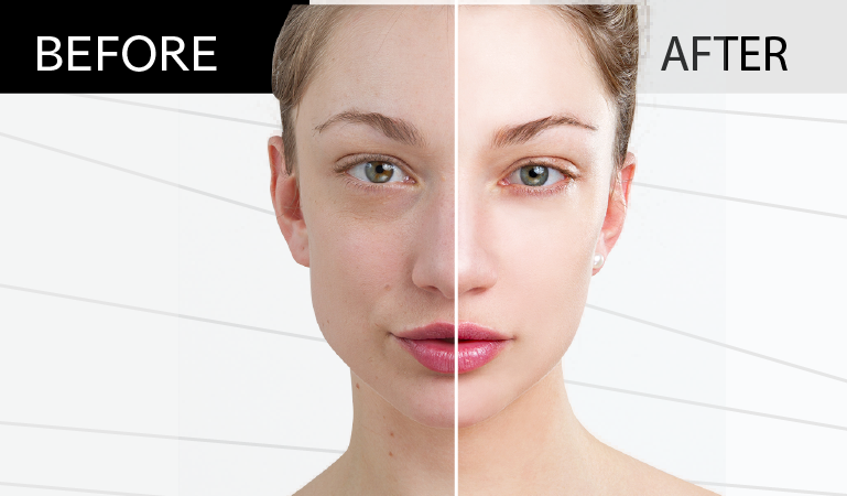 before and after picture