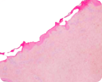 Superficial mode CW histology